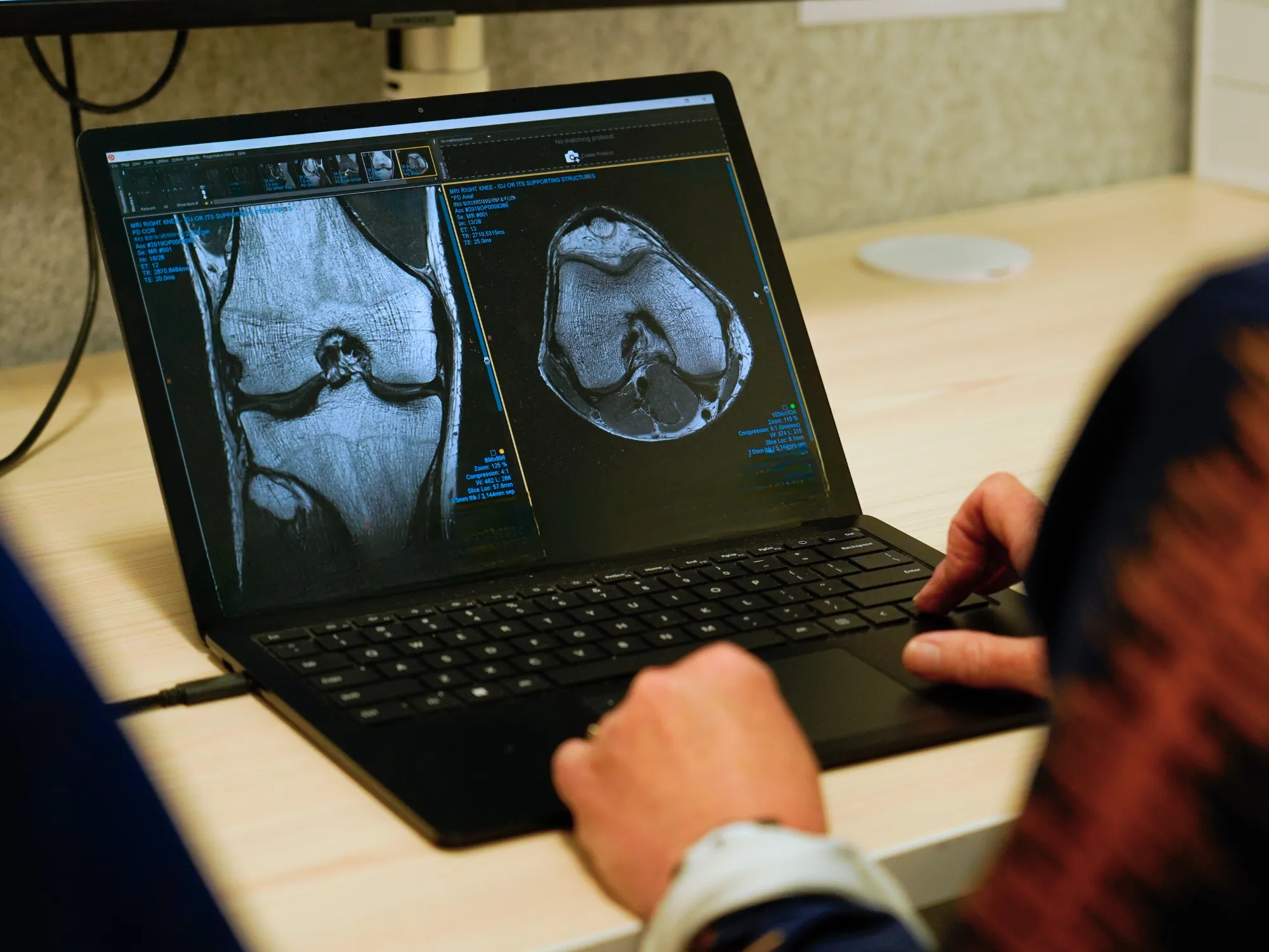 An image of a laptop sitting open on a desk with medical scans visible on screen.